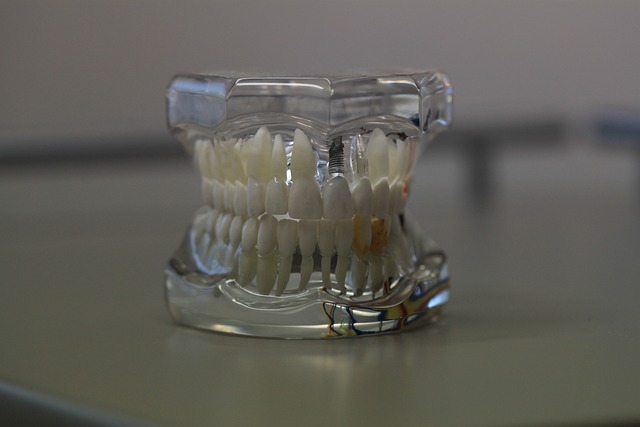 El empaquetamiento de comida entre las muelas: Â¿un problema dental?